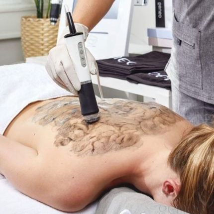 Body regeneration treatment stretch marks