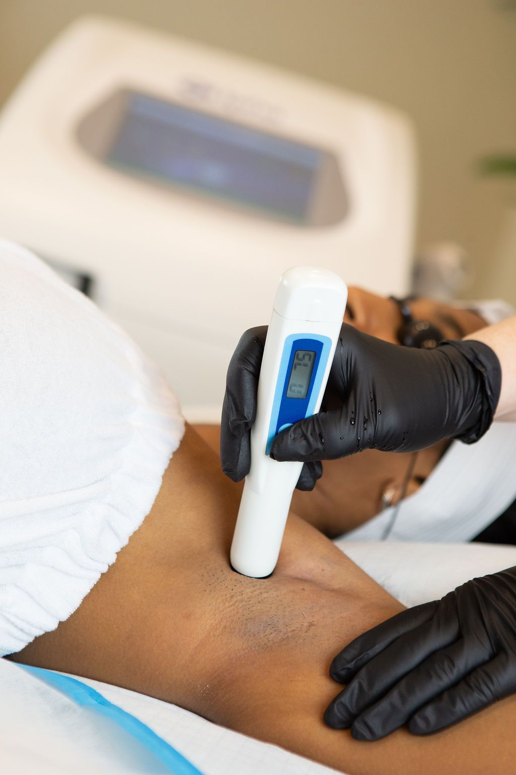 Laser hair removal in Amsterdam