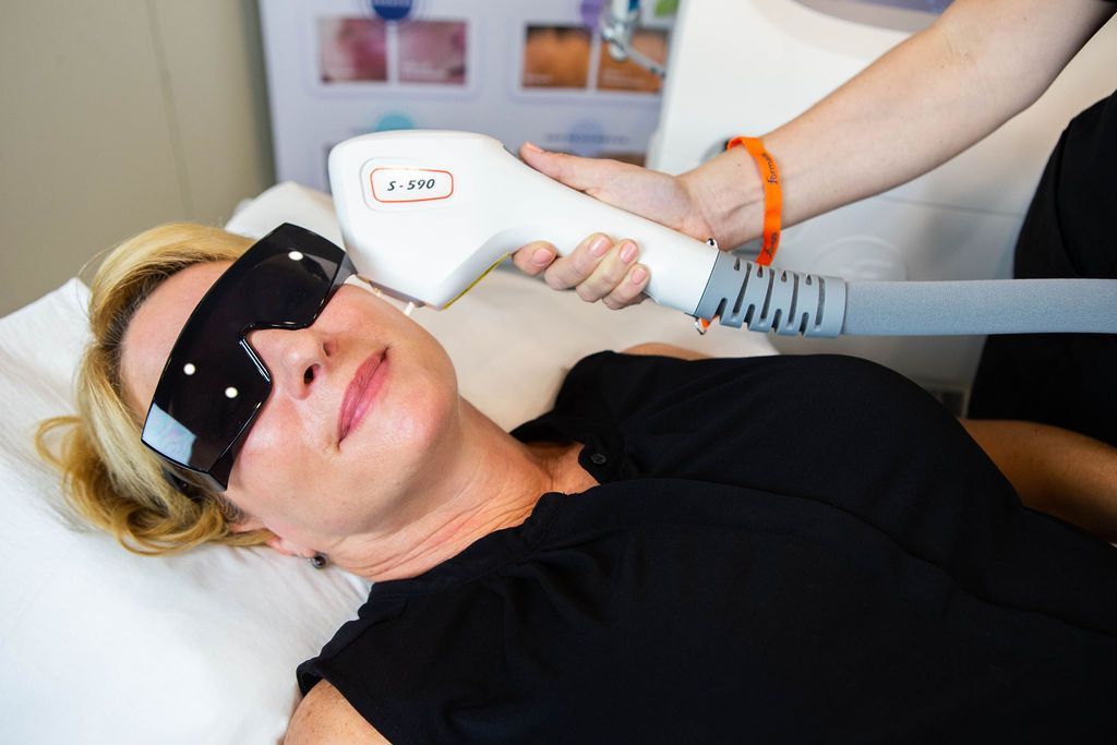 Alpha 3d IPL Laser

