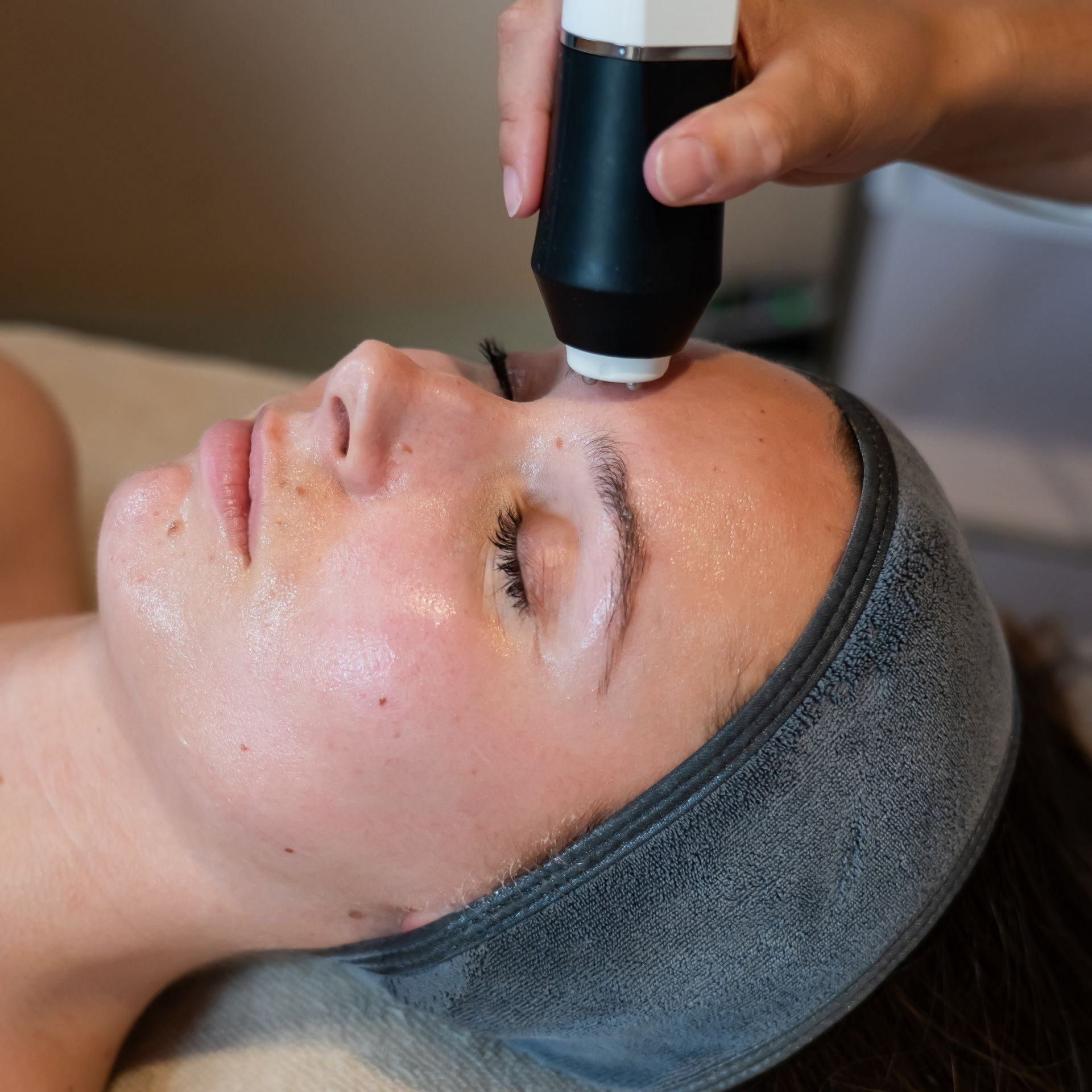 women skin improvement and anti-aging treatment amsterdam