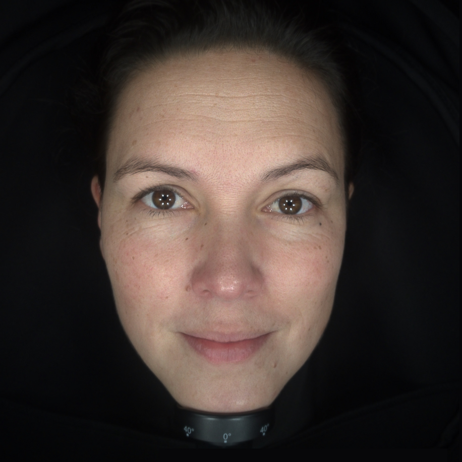 Skin Concerns