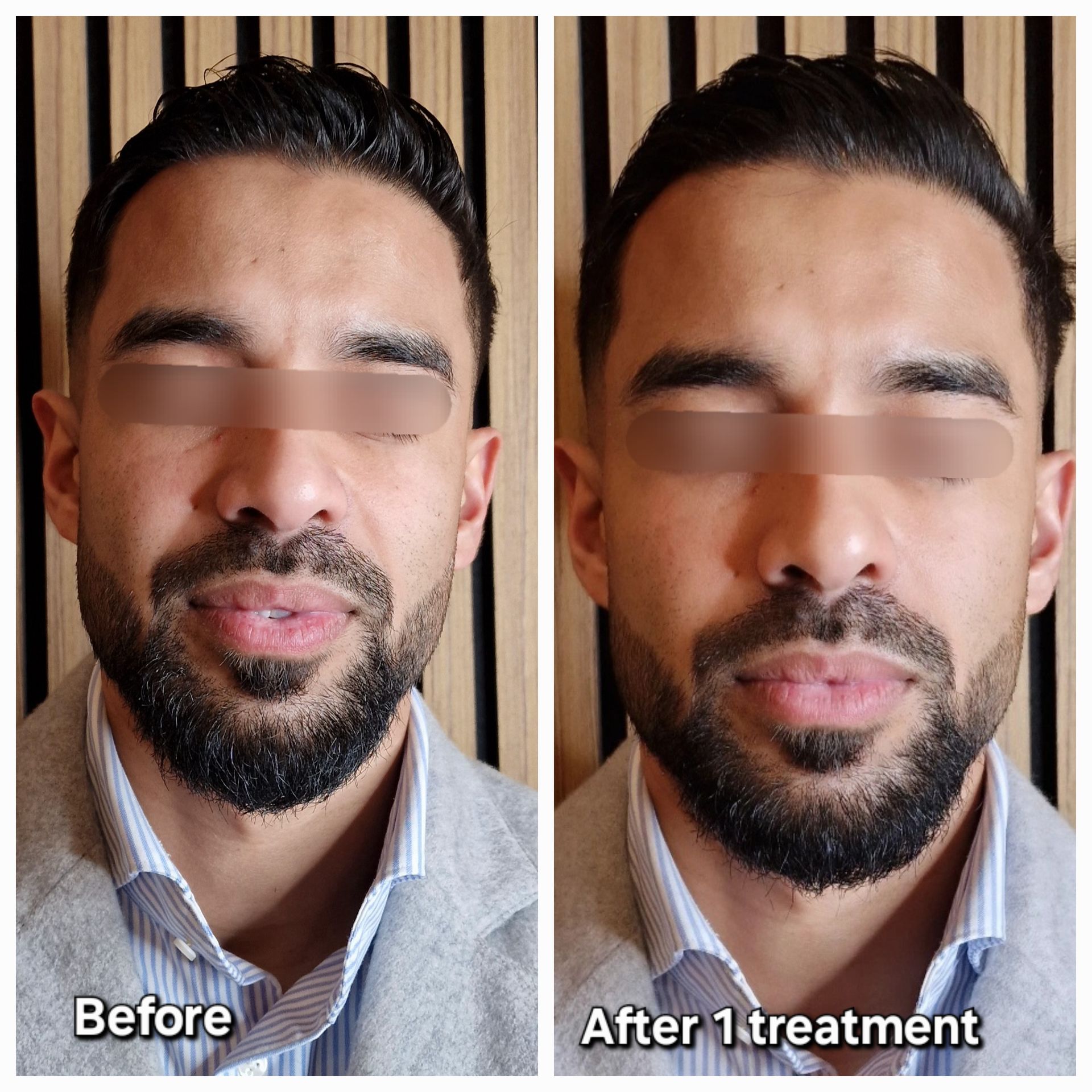 Hydrajet Before and After