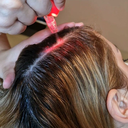 Scalp and Hair treatment