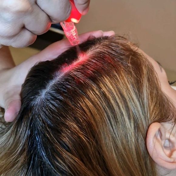 Scalp and Hair treatment