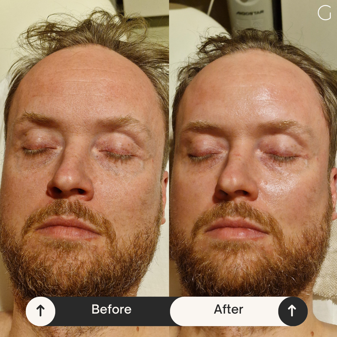 Premium kliniekbehandeling