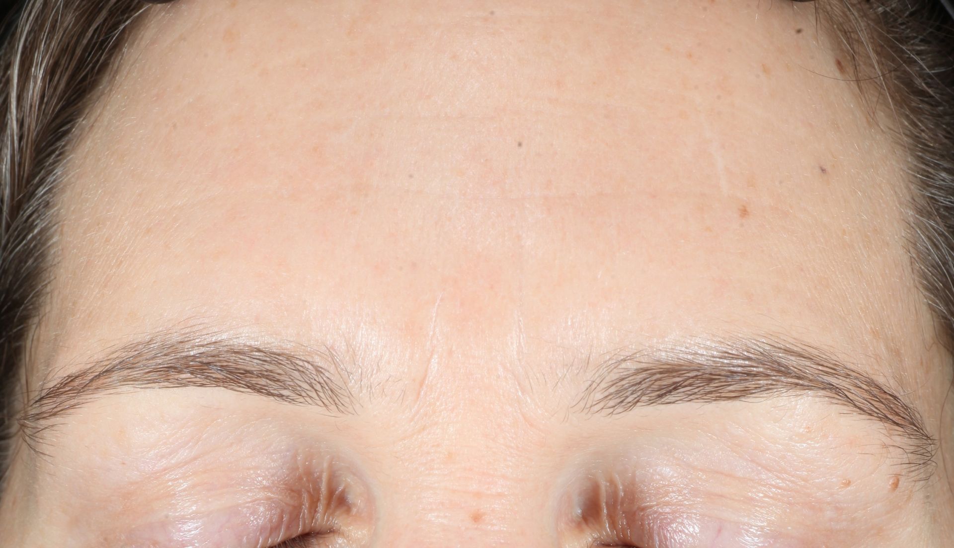 After iS Clinical Active Peel Brightening System