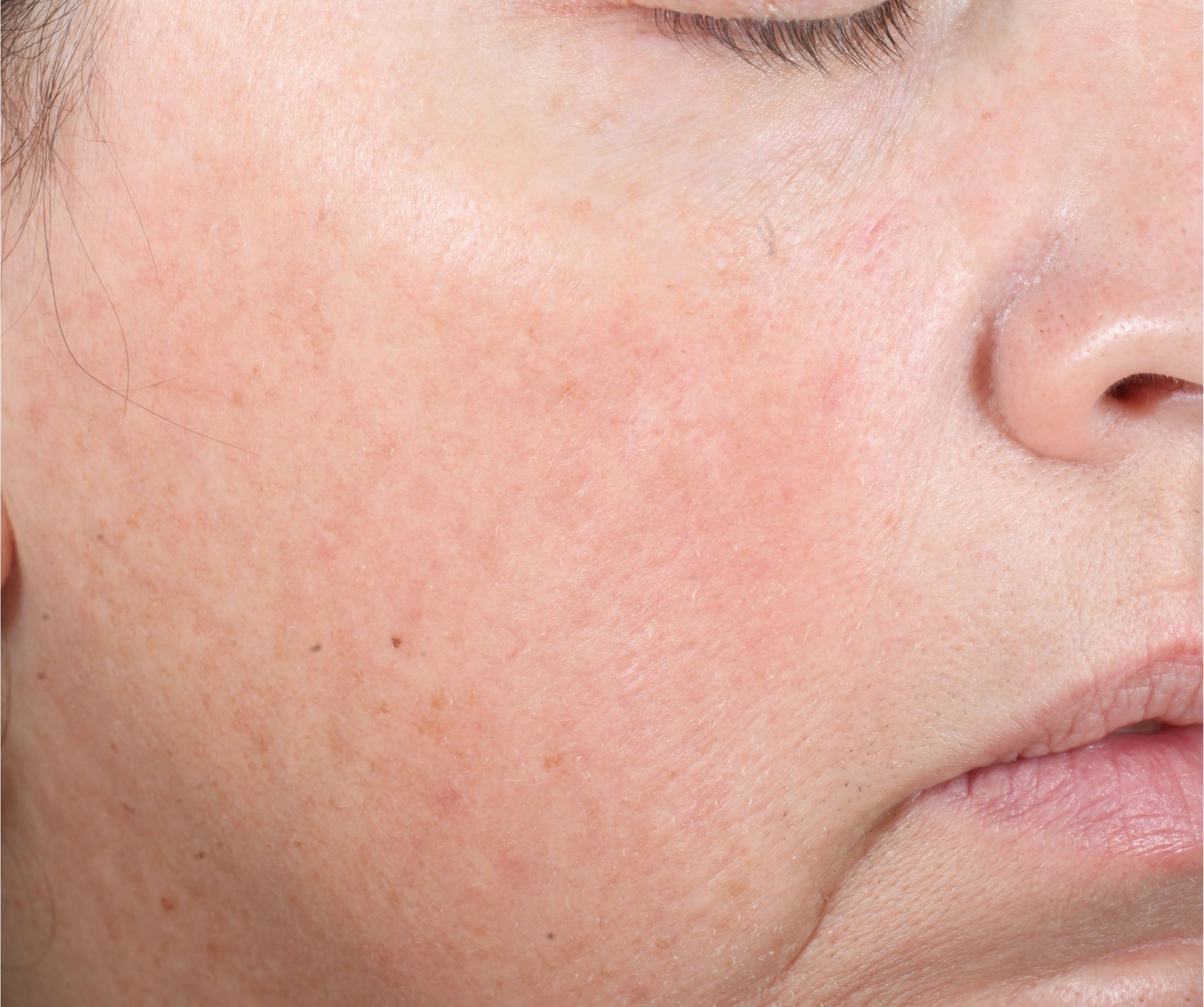 After iS Clinical Active Peel Brightening System