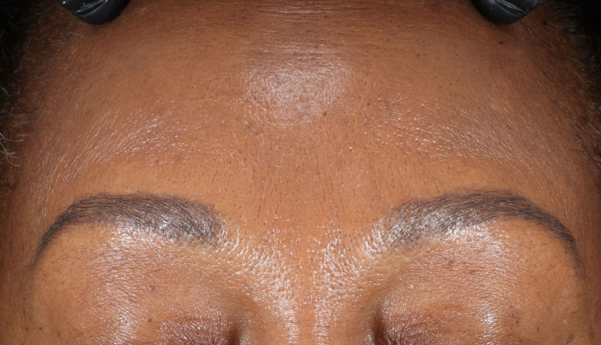 After iS Clinical Active Peel Brightening System