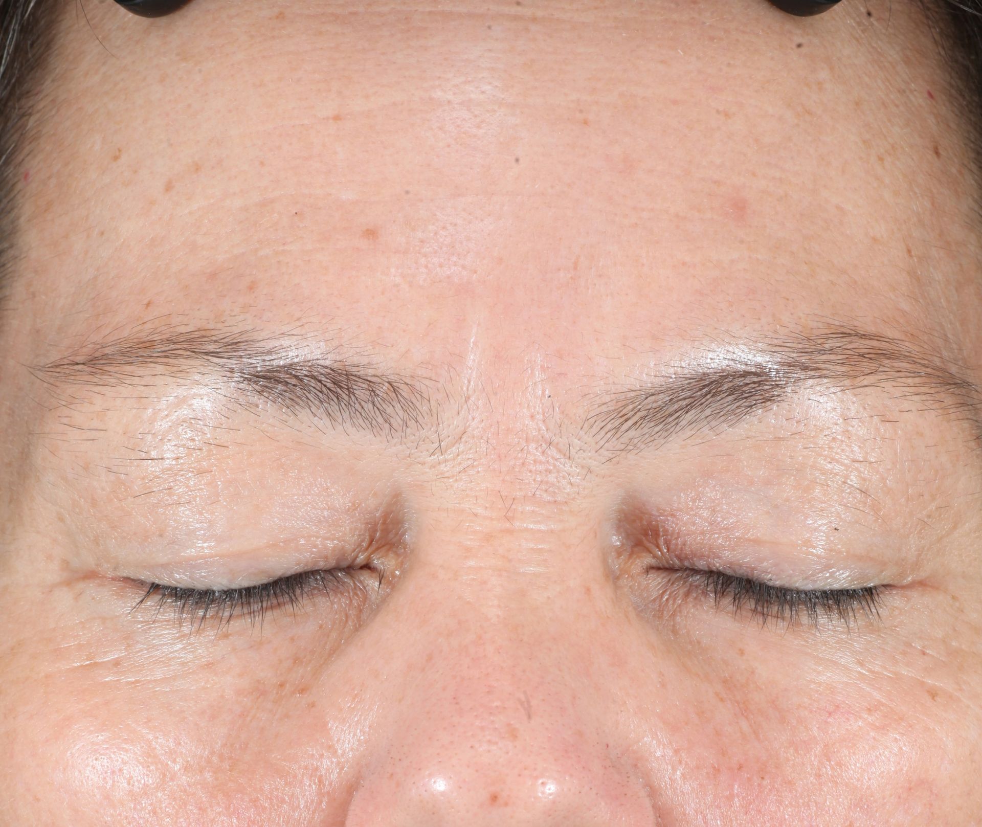 After iS Clinical Active Peel Brightening System