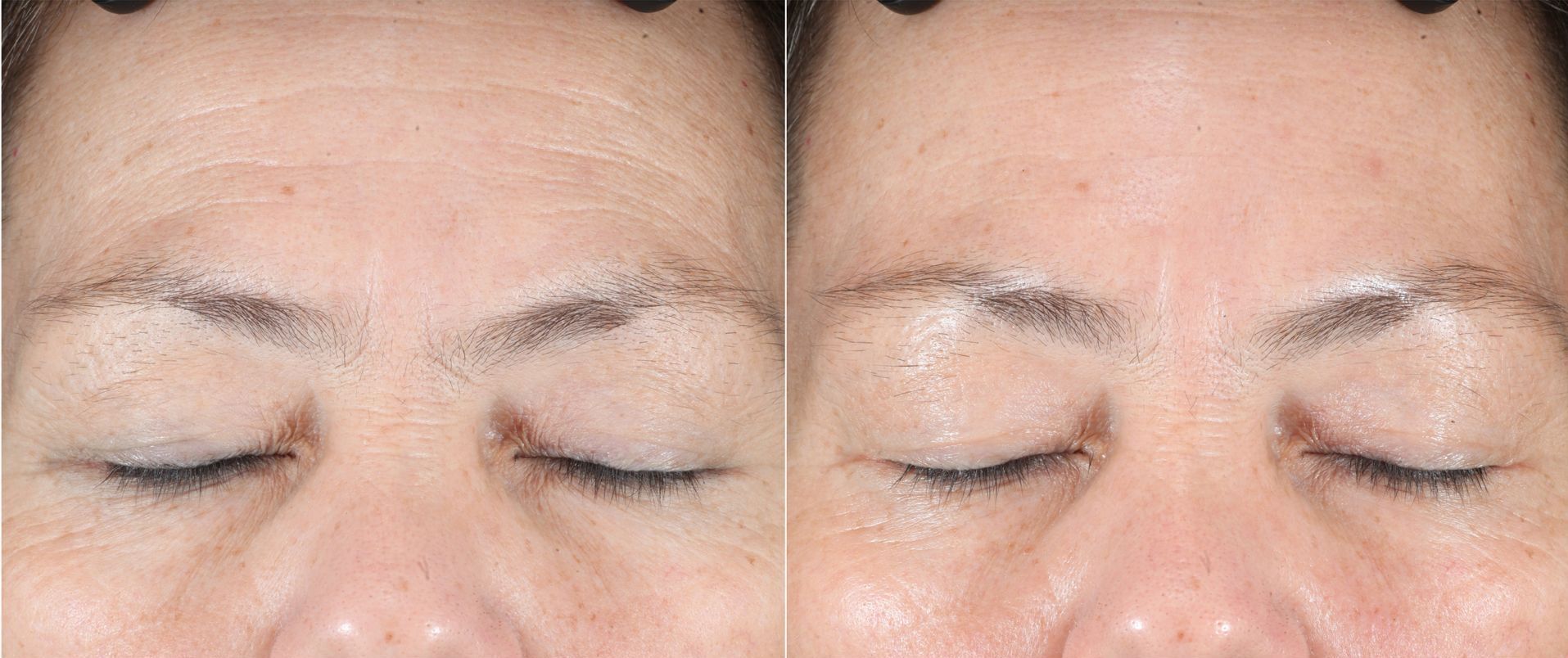 iS Clinical Cleansing Complex and Active Serum - treat your skin to the best