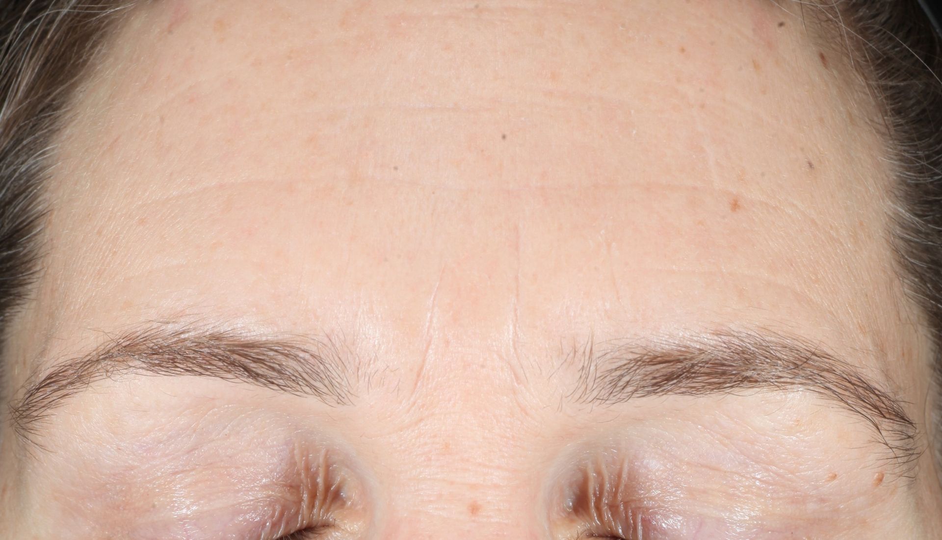Before iS Clinical Brightening system