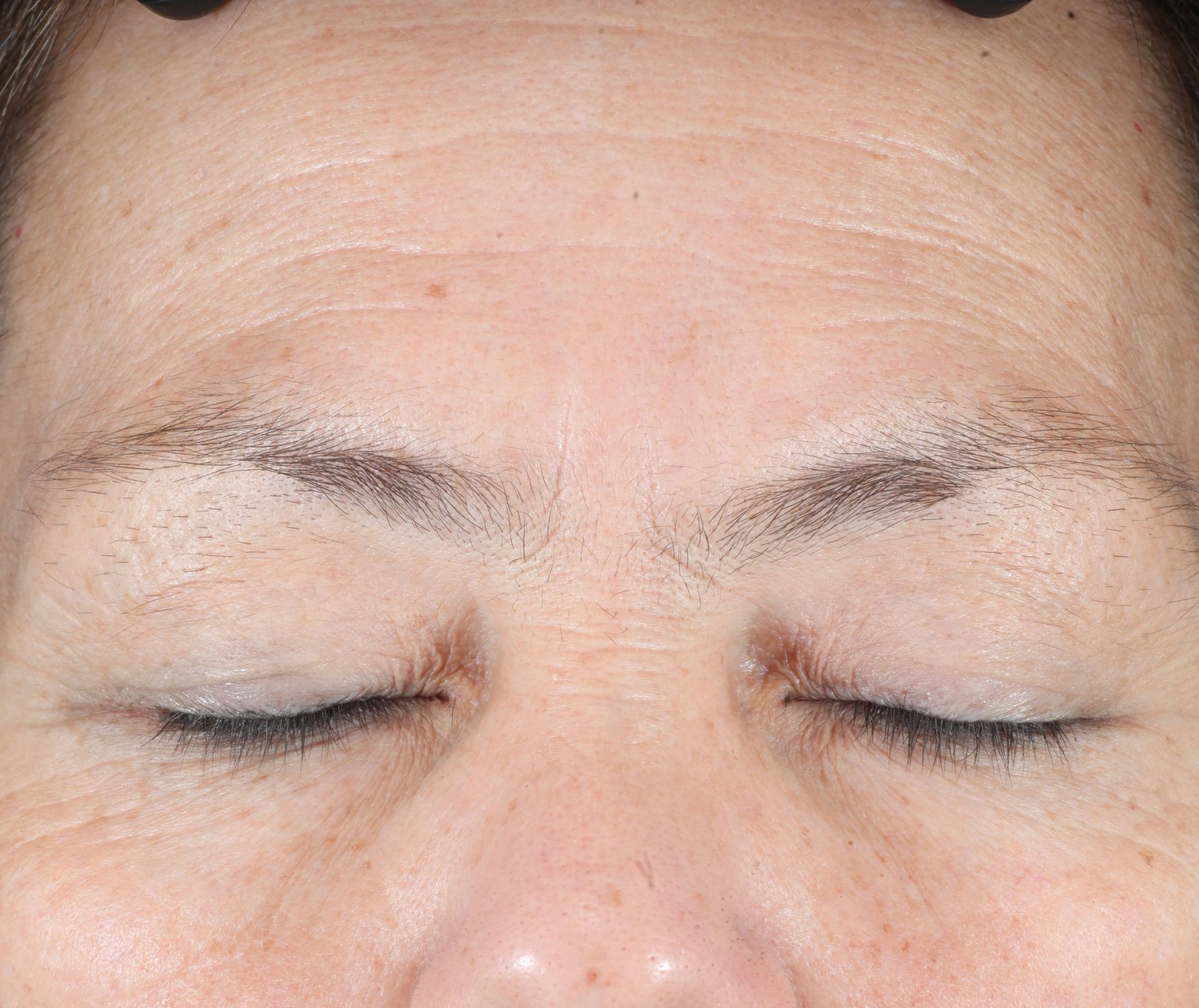 Before iS Clinical Brightening system