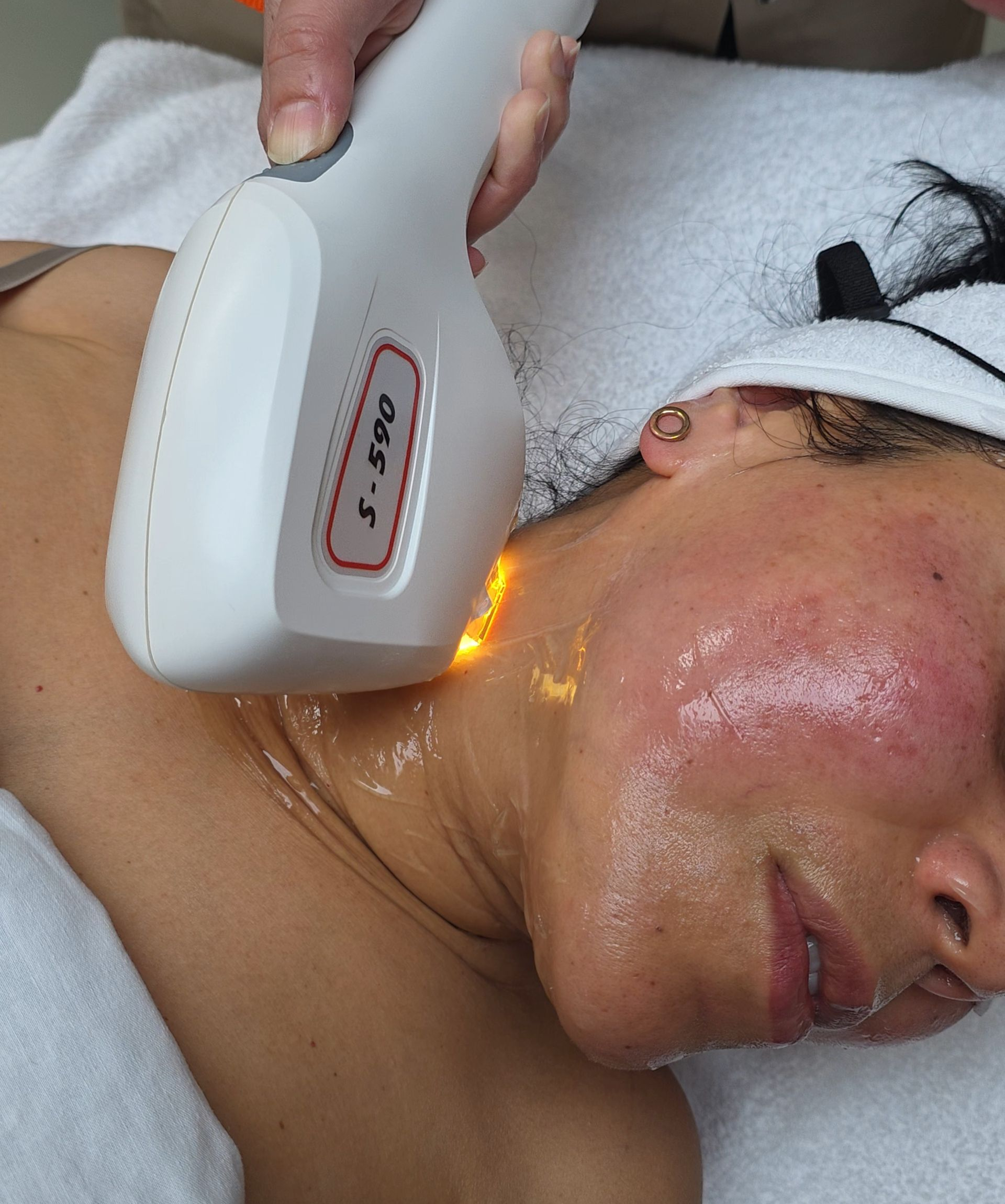 Tight and Bright huidverjonging behandeling Amsterdam bij Gustil Aesthetics