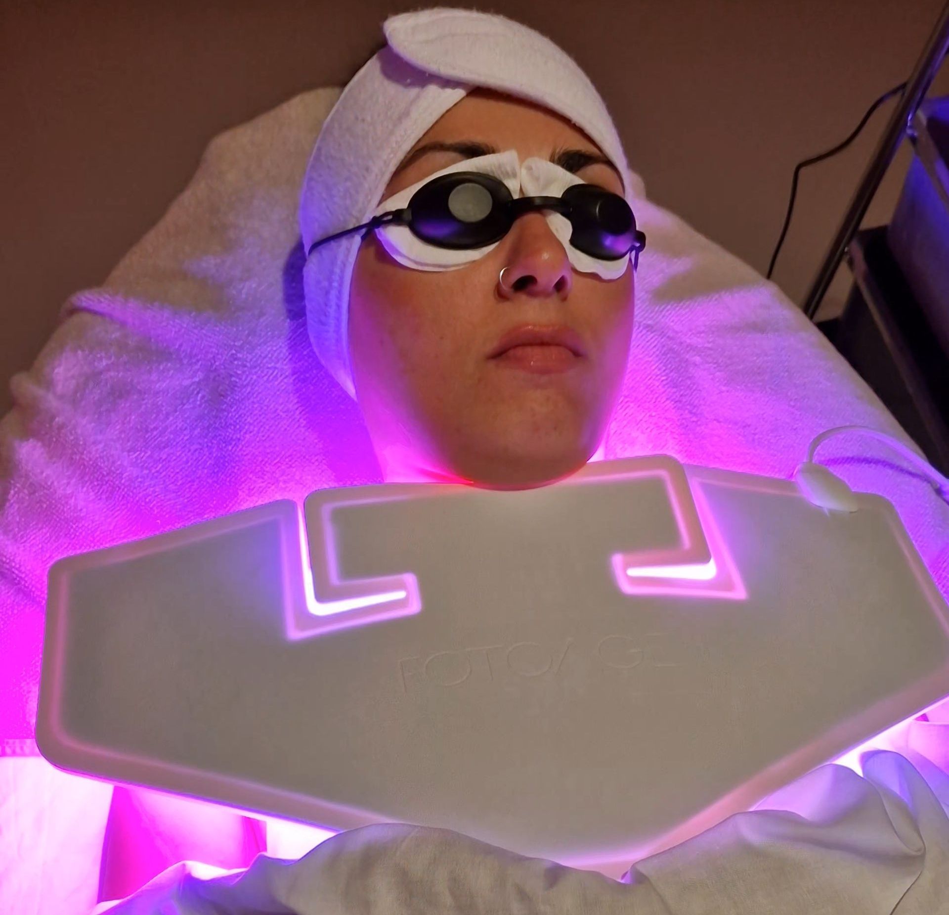 PhotoBiodynamic Therapy  Acne Treatment with Violet light