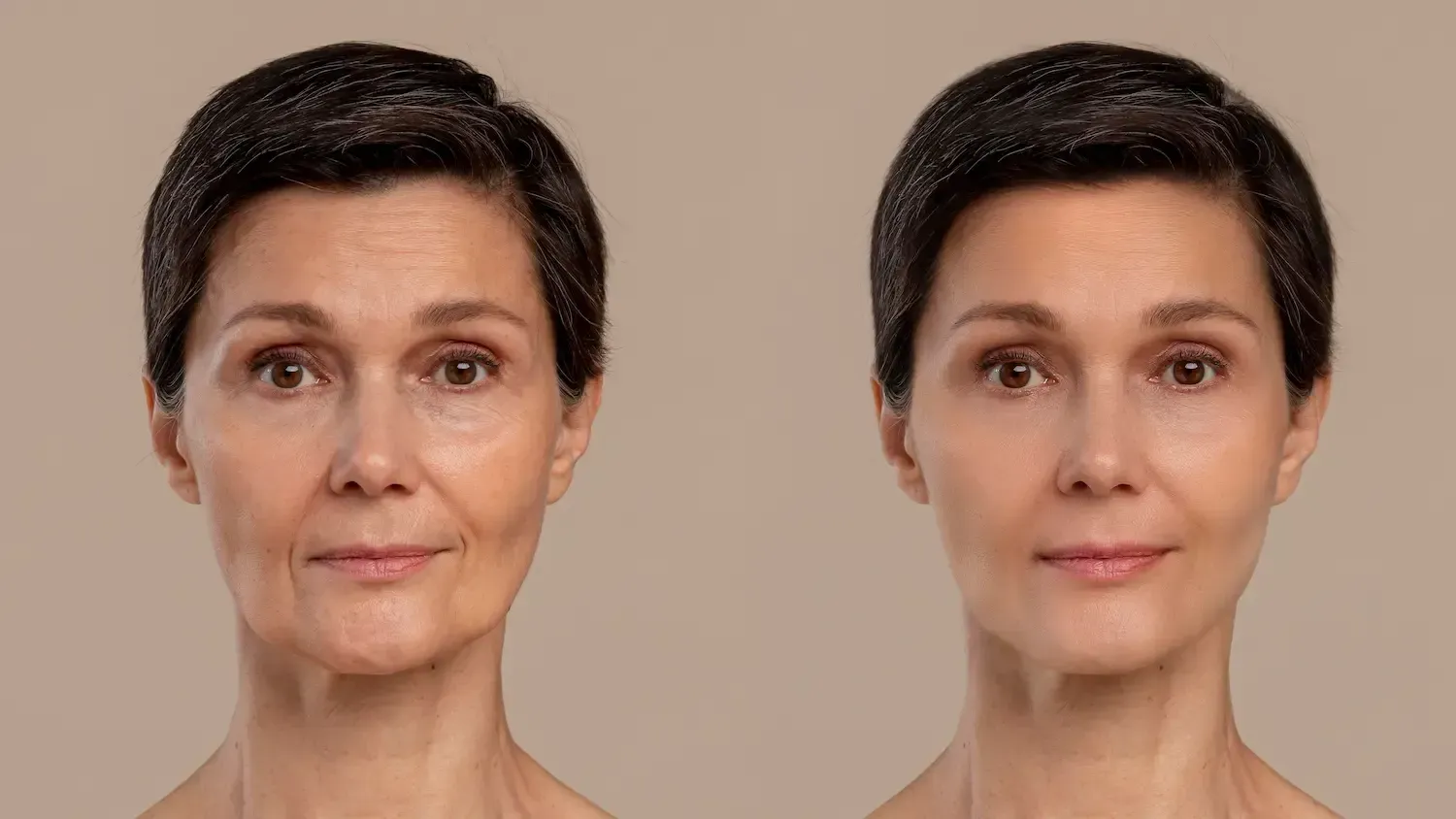 Lady with treating Under-eye