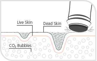 Oxygeneo exfoliation