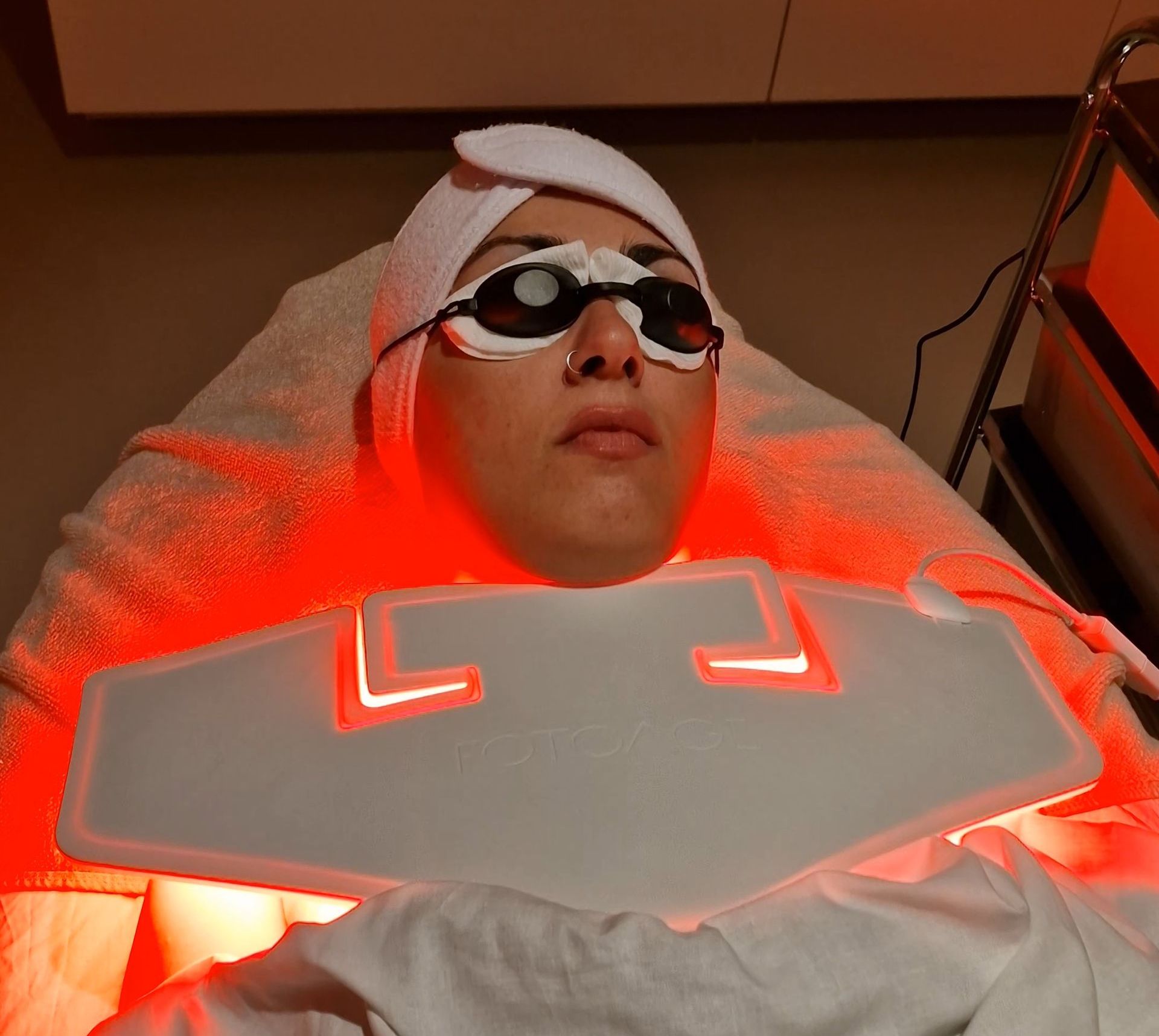 PhotoBioDynamic Therapy Couperose treatment