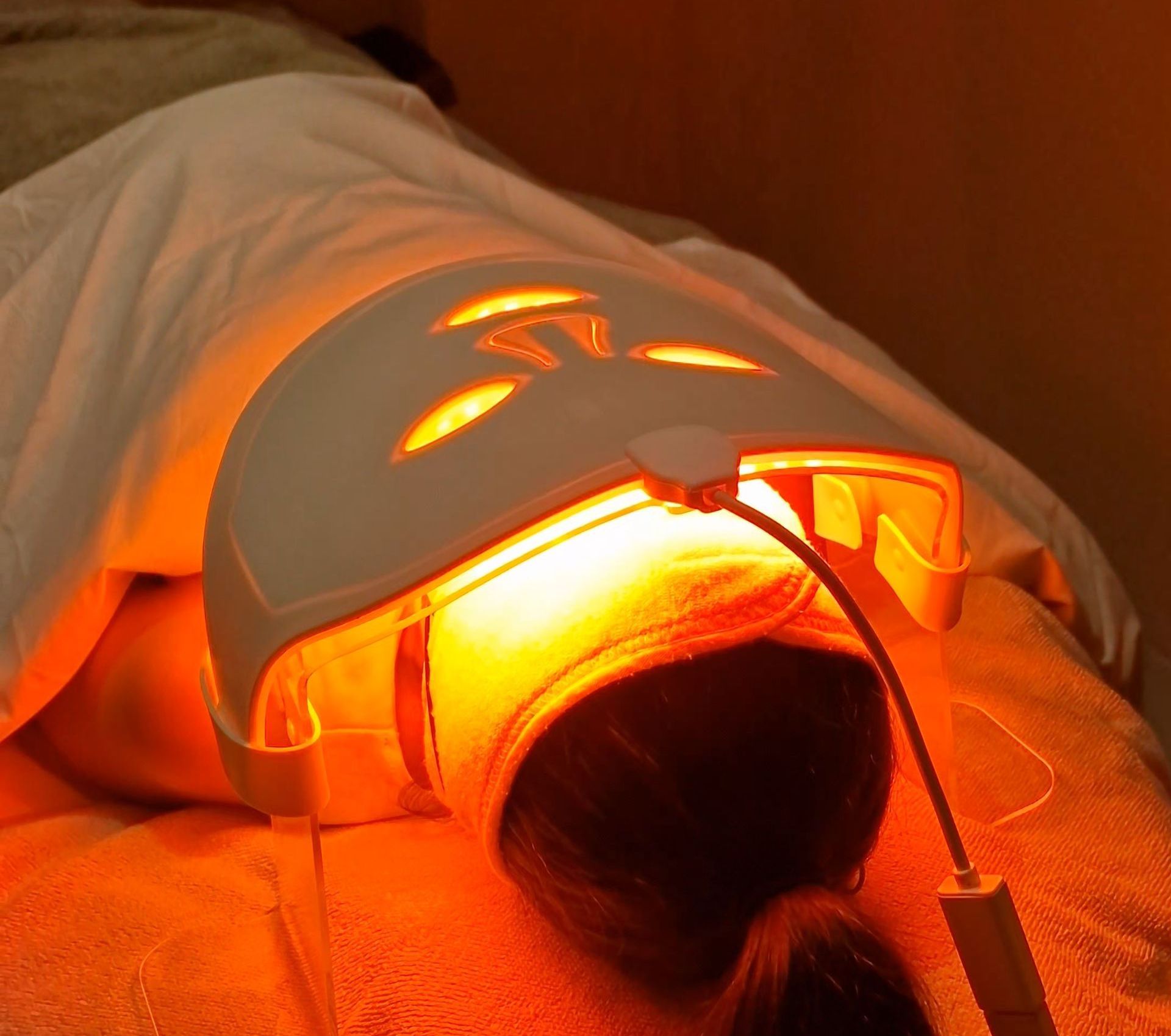 PhotoBiodynamic Therapy Acne Neck