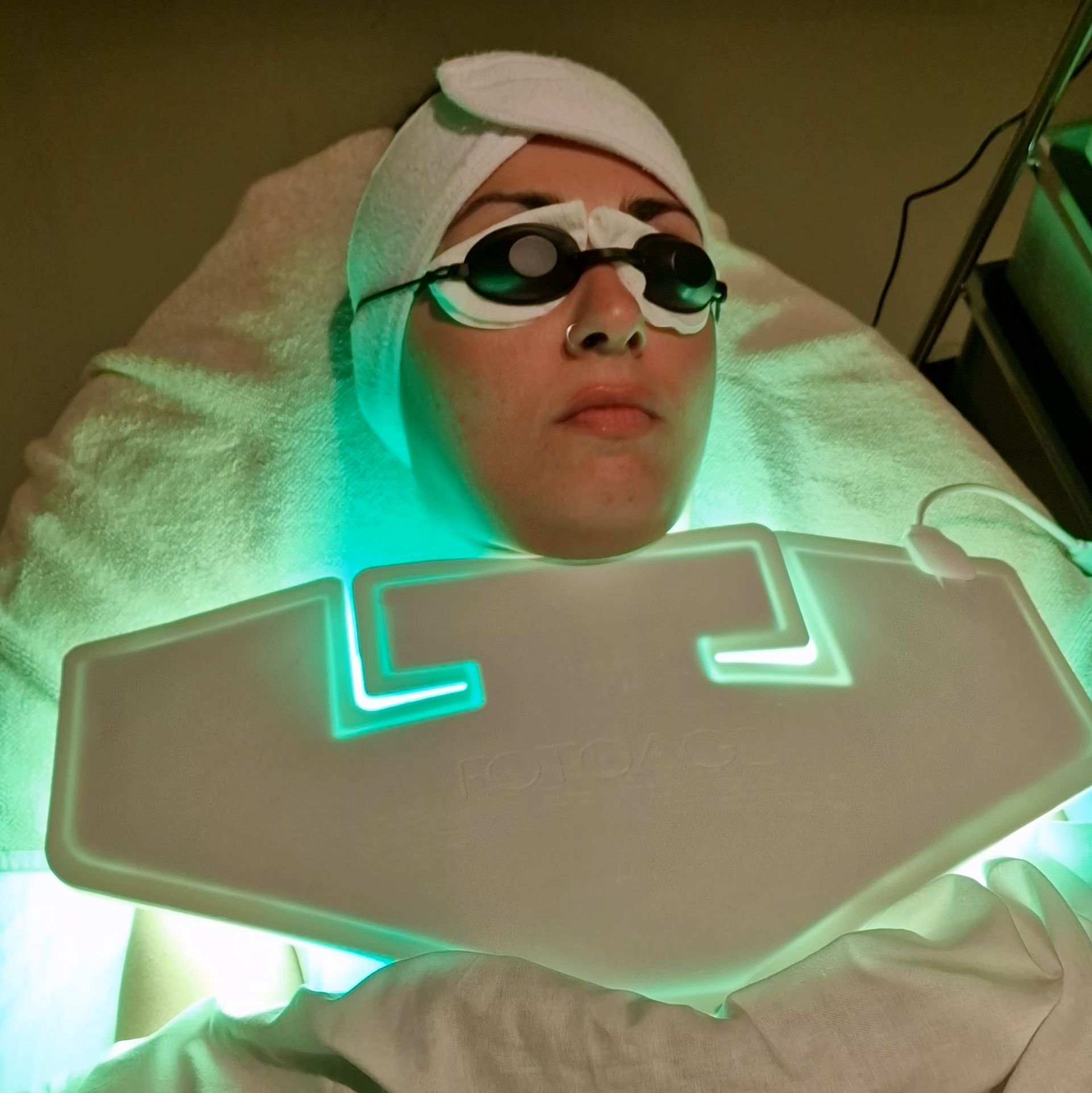 PhotoBioDynamic Light therapy for hyperpigmentation with green light
