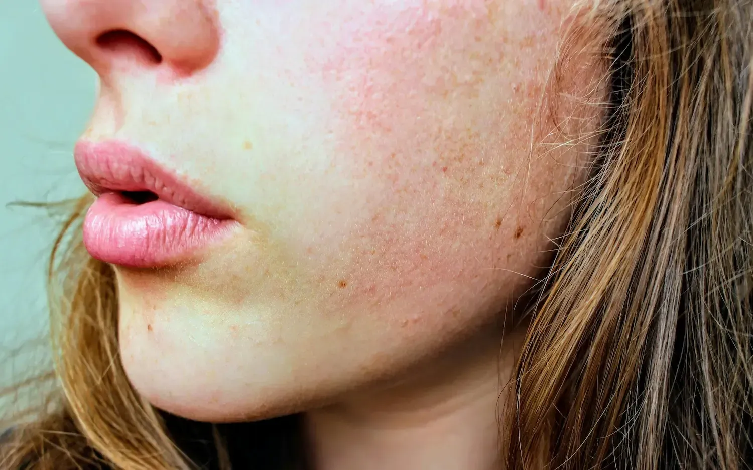Lady with treating Under-eye
