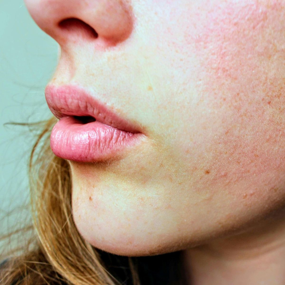 Dry Skin Skincare Products