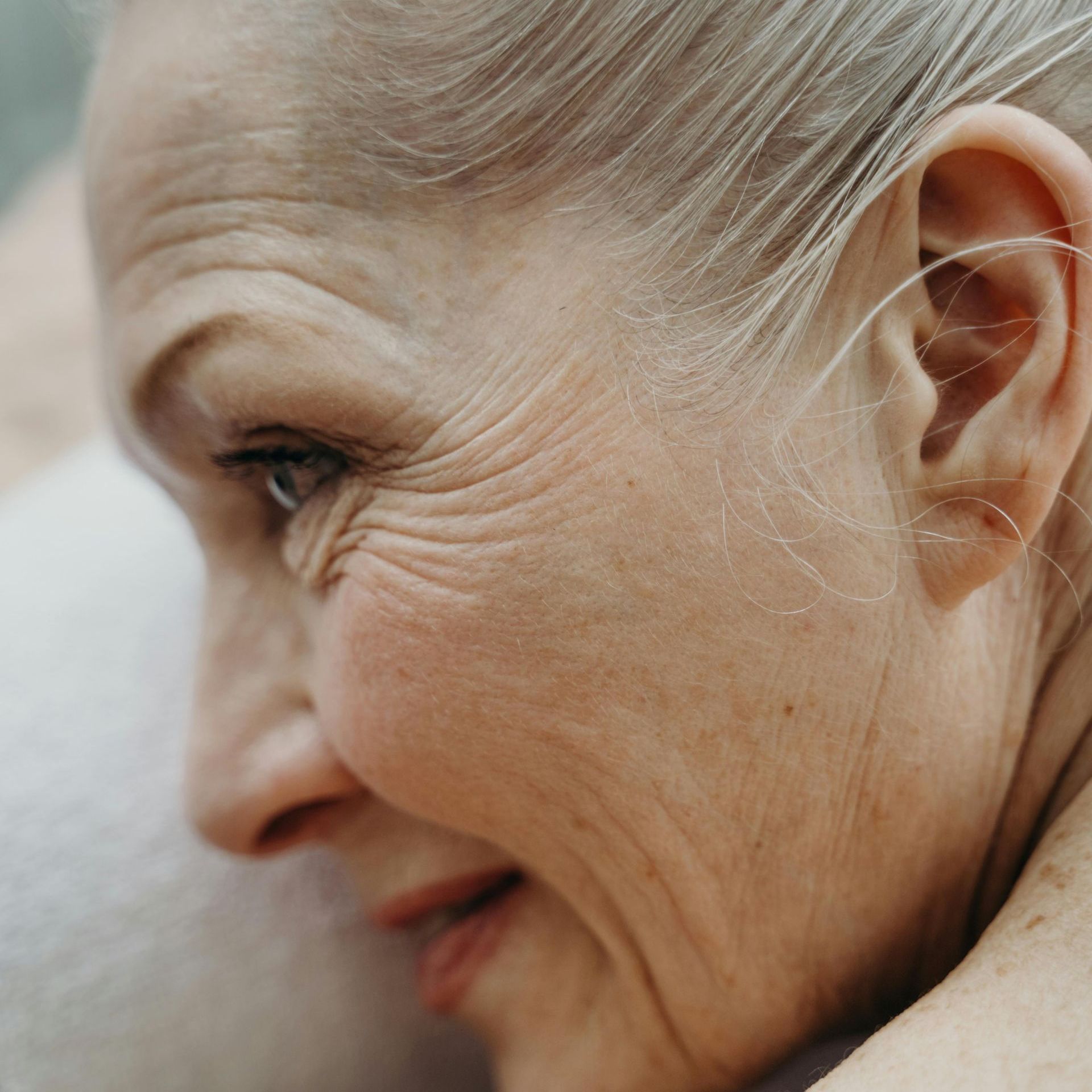 Wrinkles and fine lines