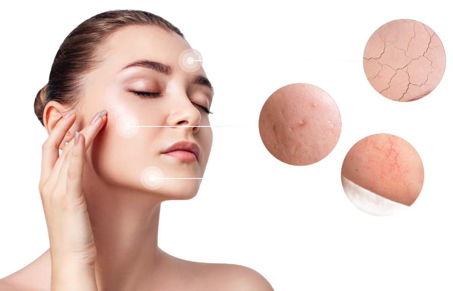 Skin Conditions and concerns