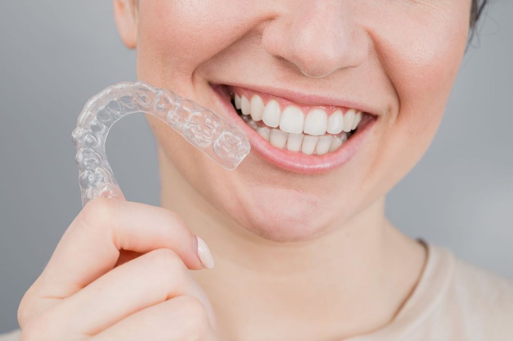 Una donna tiene un apparecchio trasparente davanti ai denti.