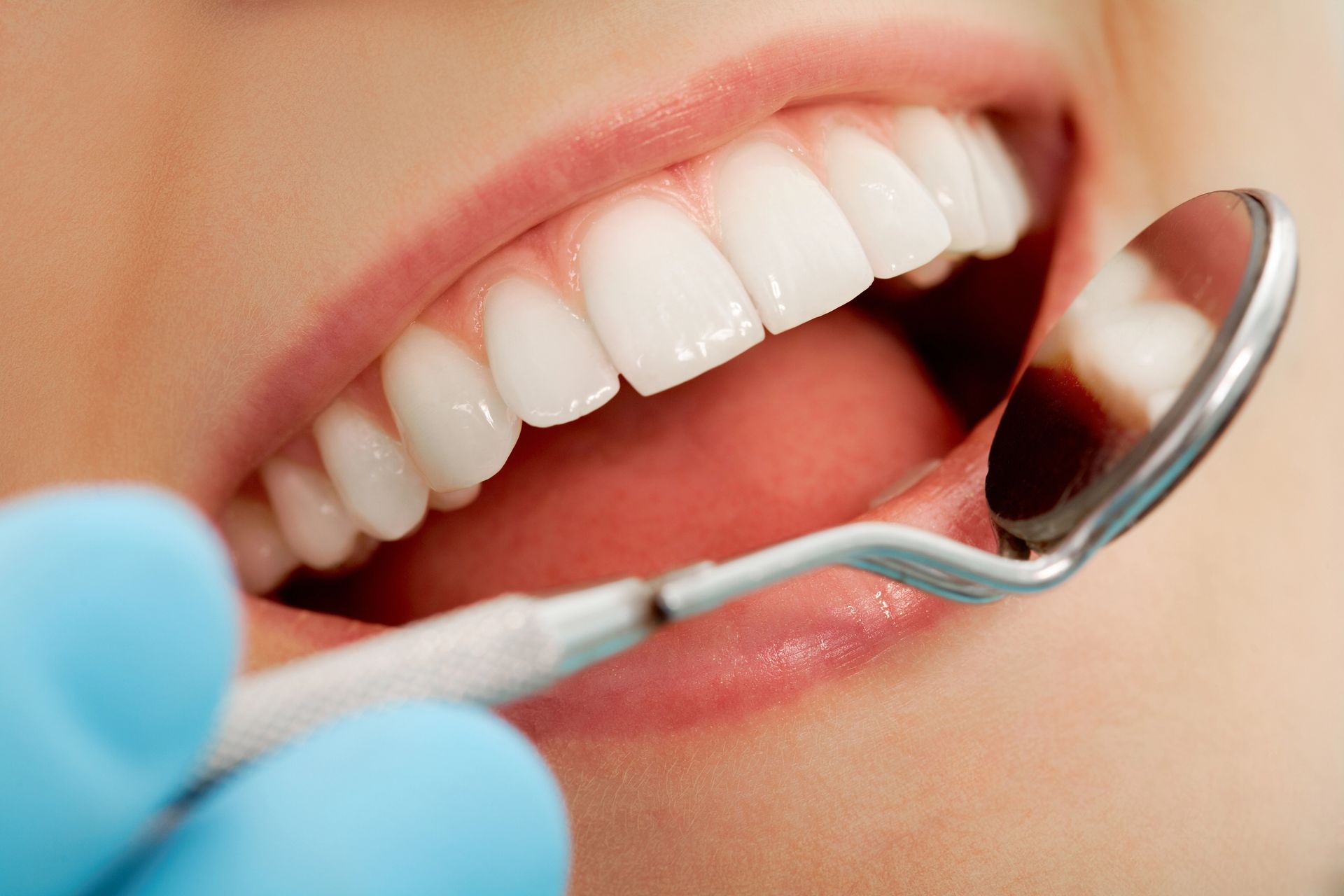 Un dentista tiene un apparecchio trasparente sui denti di un paziente.