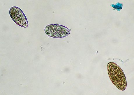 Liver and Stomach Fluke Counts