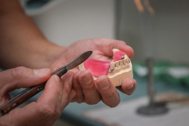 Denture Repairs in Mildura