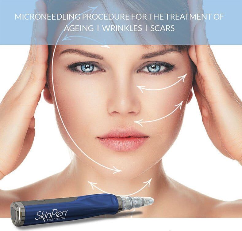 A woman is getting a microneedling procedure for the treatment of ageing wrinkles and scars