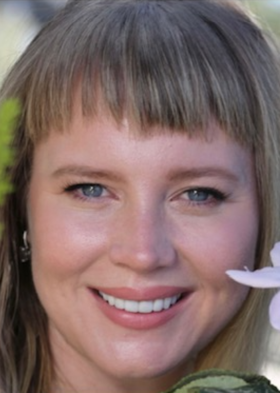 Before Full-Mouth Reconstruction