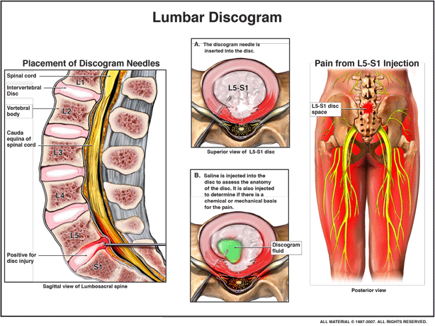 LAD Artery — Cincinnati, OH — Litigation Support Services