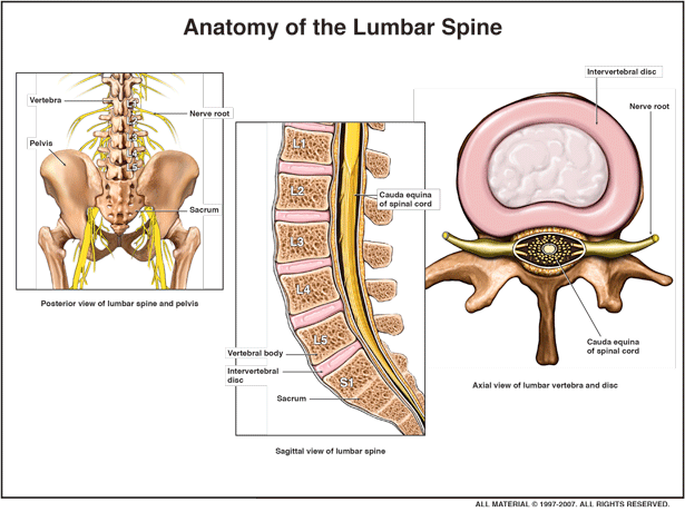 Lumbar Discogram — Cincinnati, OH — Litigation Support Services