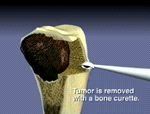 Bone Animation — Cincinnati, OH — Litigation Support Services