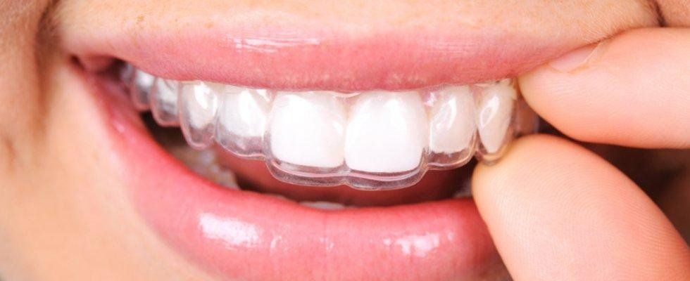 protesi dentarie mobili