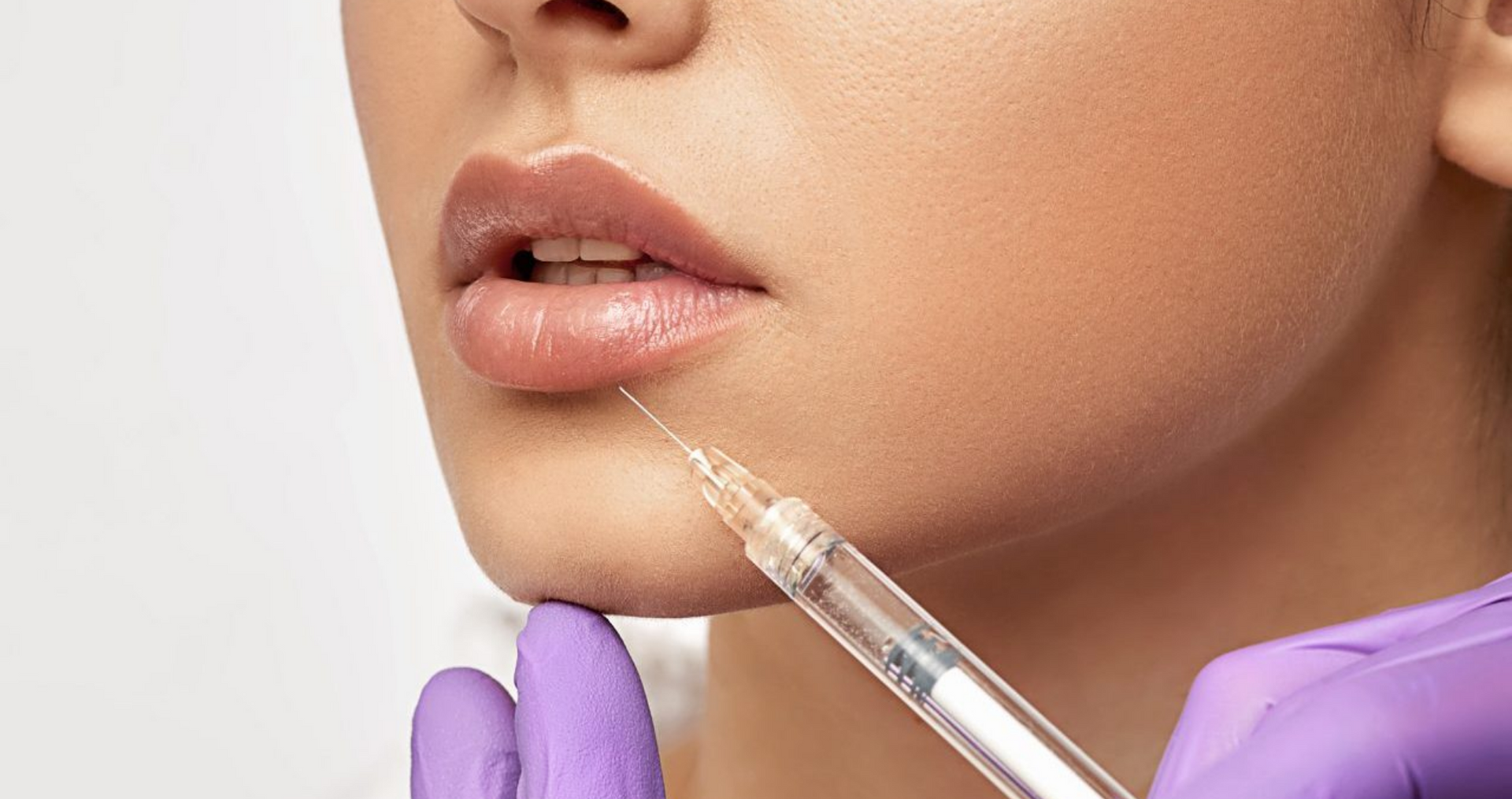 Eine Frau bekommt eine Botox-Injektion in die Lippen.