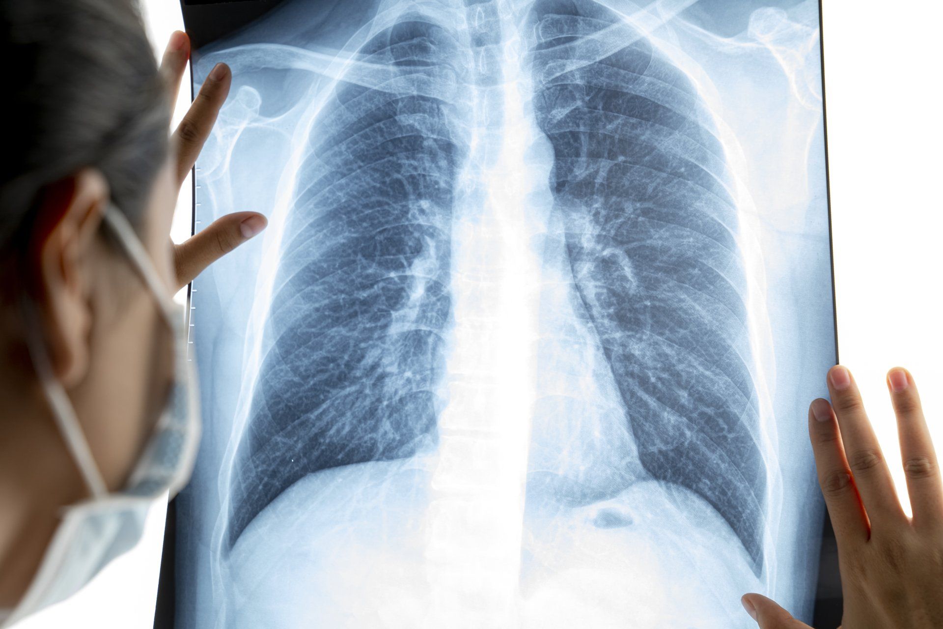 Female doctor analyzing lung x-ray film — New Hartford, NY — Oxford Medical Imaging