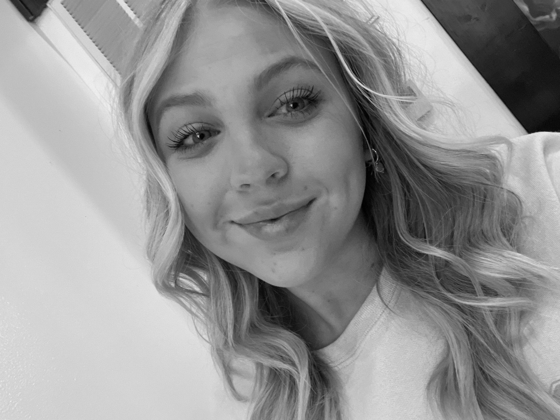 Beautiful Lips — Midlothian, TX — Lift Medical Aesthetics