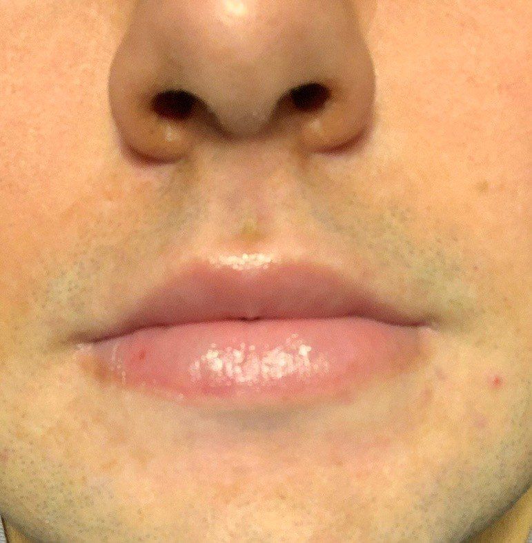 A close up of a person 's nose and lips in a black and white photo.