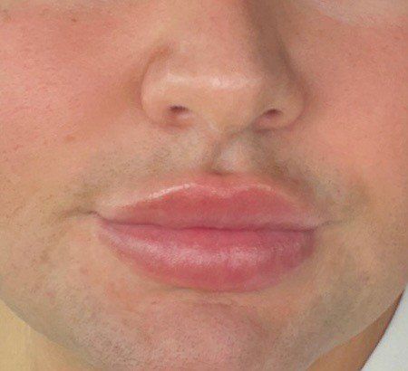 A black and white drawing of a man 's face with his mouth open.