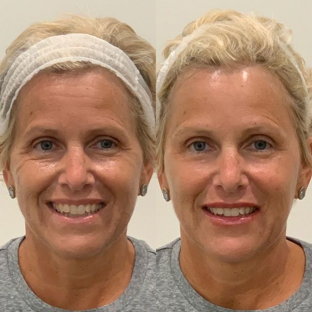 Two women are smiling in a black and white photo.