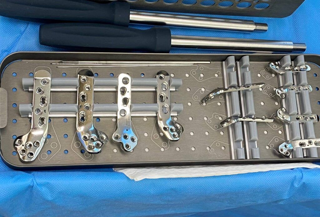 Surgical instruments and plates in a metal tray on a blue surface, likely in an operating room setting.
