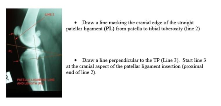 X-ray of a knee with lines indicating measurement points: patellar ligament and tibial tuberosity.