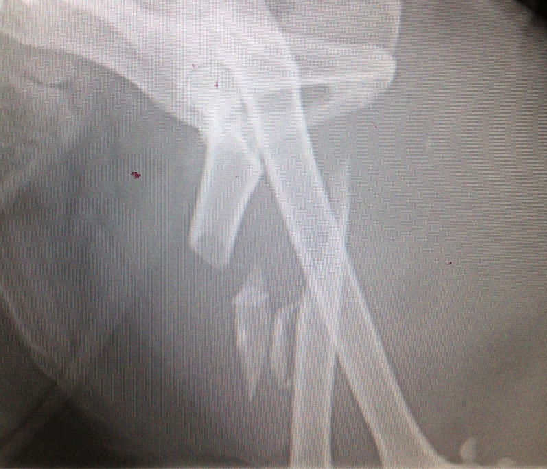Geoffrey&rsquo;s Fracture Repair by Dr Sam Haynes