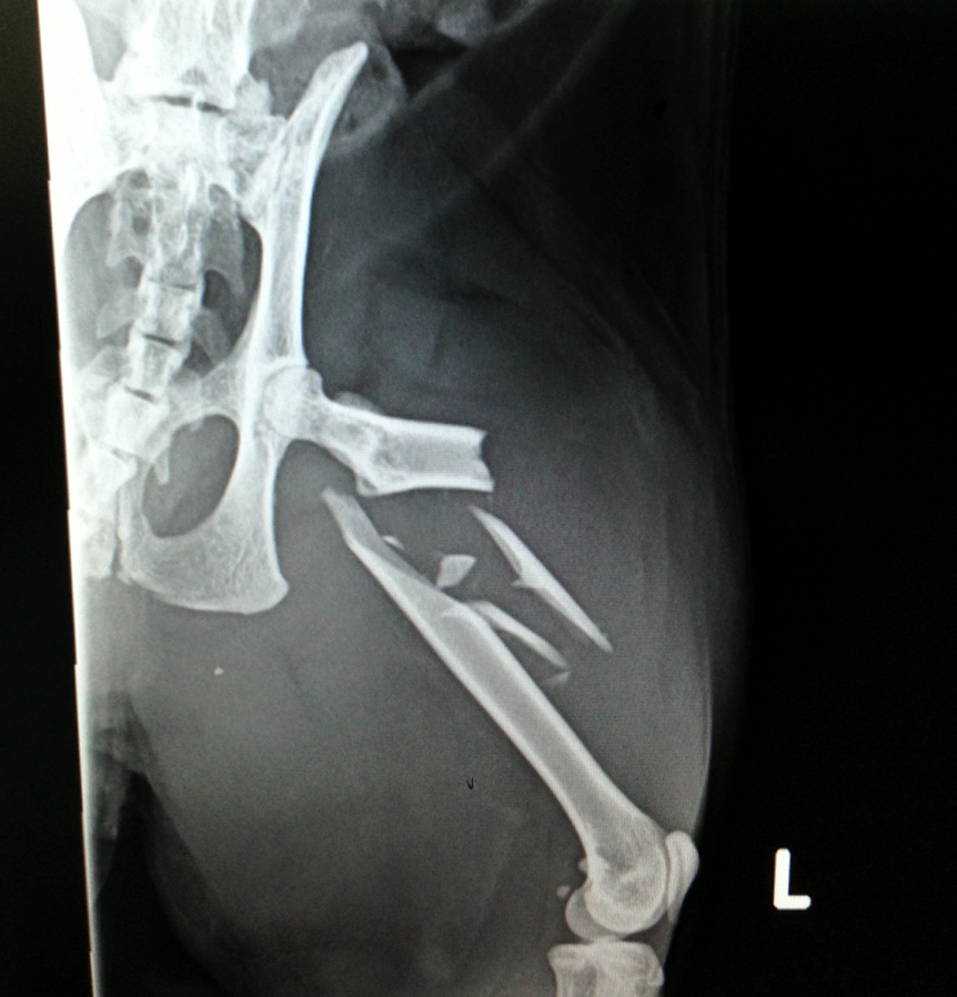 X-ray of a human leg with multiple fractures to the femur. The hip joint and pelvis are also visible.