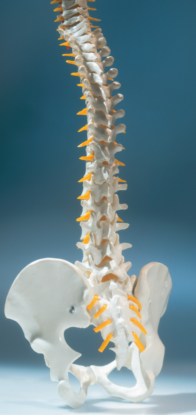 Model of a spine and pelvis, against a blue backdrop. The vertebrae are white, and the discs are yellow.