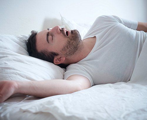 A man sleeping representing Sleep Apnea