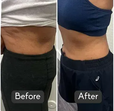 Medical Weight Loss Programs | Healthy Ascent Wellness and Weight Loss  Clinic